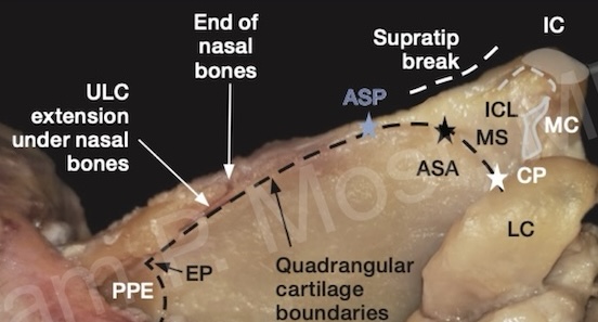 Fig 1-17