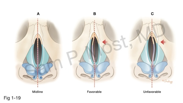 Fig 1-19