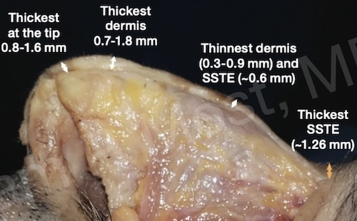 Fig 1-3