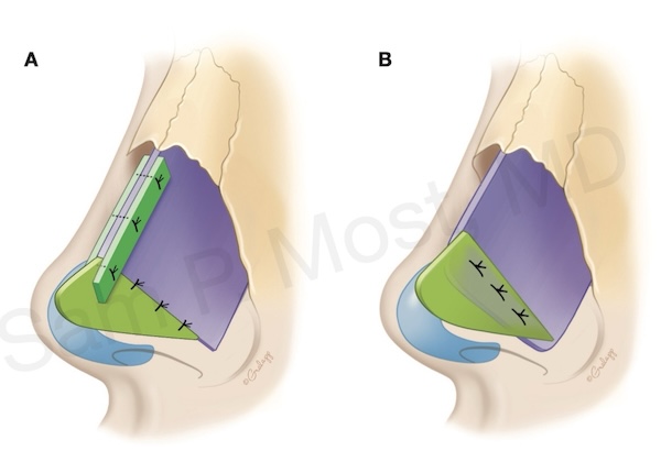 Fig 10-2