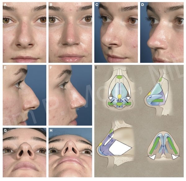Fig 10-24