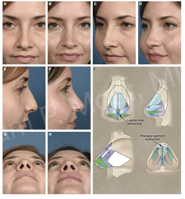Fig 10-31