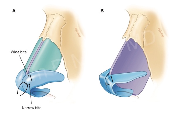 Fig 10-40
