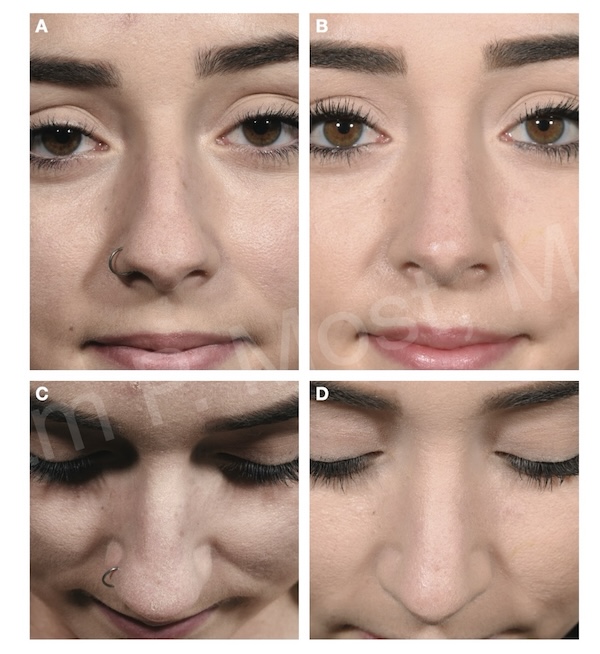 Fig 10-5