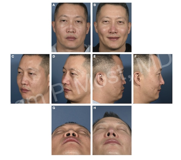 Fig 12-10