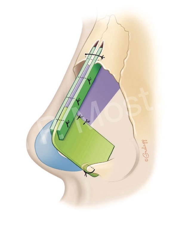 Fig 12-3
