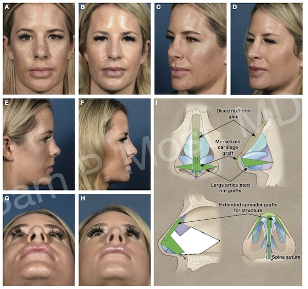Fig 12-6