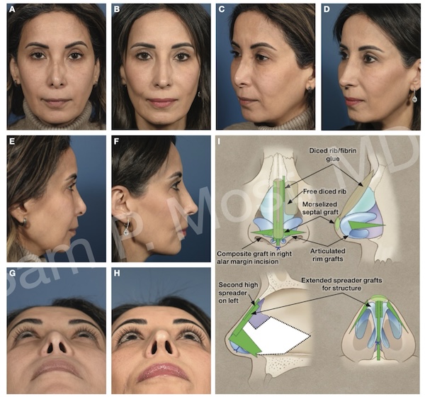 Fig 12-7