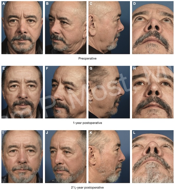 Fig 12-8