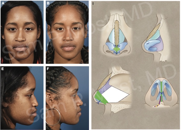Figure 15–12: Patient 1