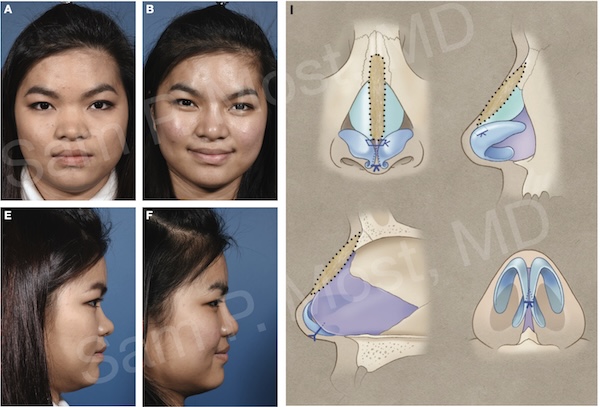 Figure 15–14: Patient 2
