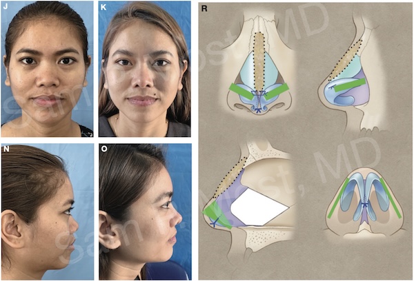 Figure 15–15: Patient 3