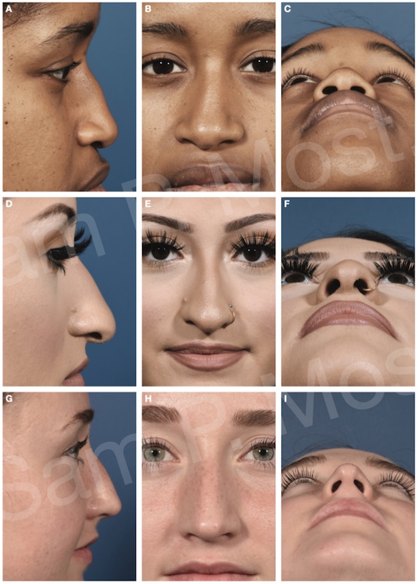 Figure 15–2: Patient types