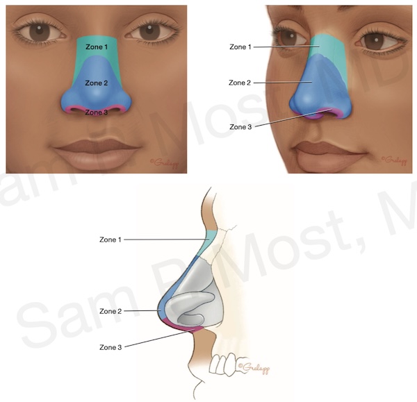Figure 15–6: SSTE zones