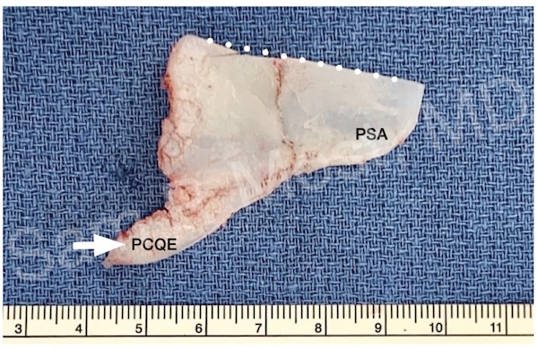 Fig 16-2