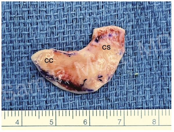 Fig 16-3