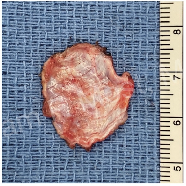 Fig 16-8
