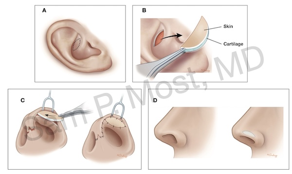 Fig 16-9