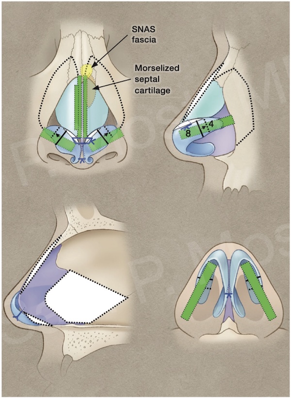 Diagram of procedures performed
