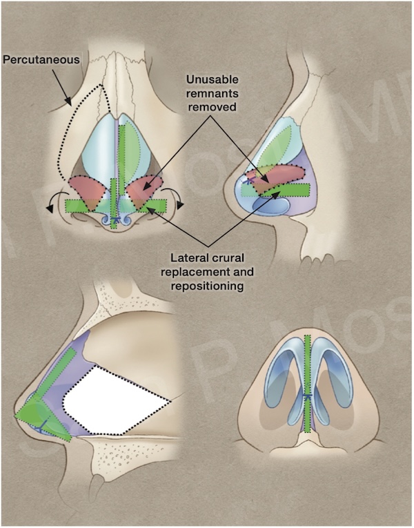 Diagram of caudal tetrapod reconstruction