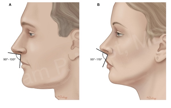 Fig 3-12