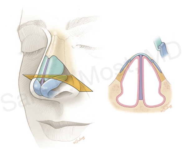 Fig 3-15