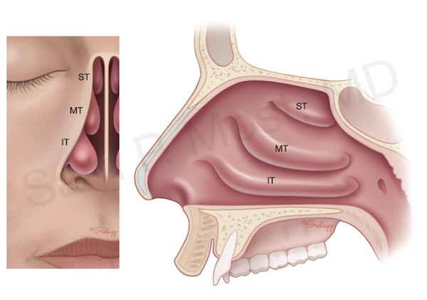 Figure 3–16: Nasal turbinates anatomy