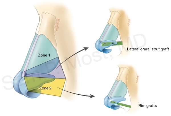 Fig 3-18