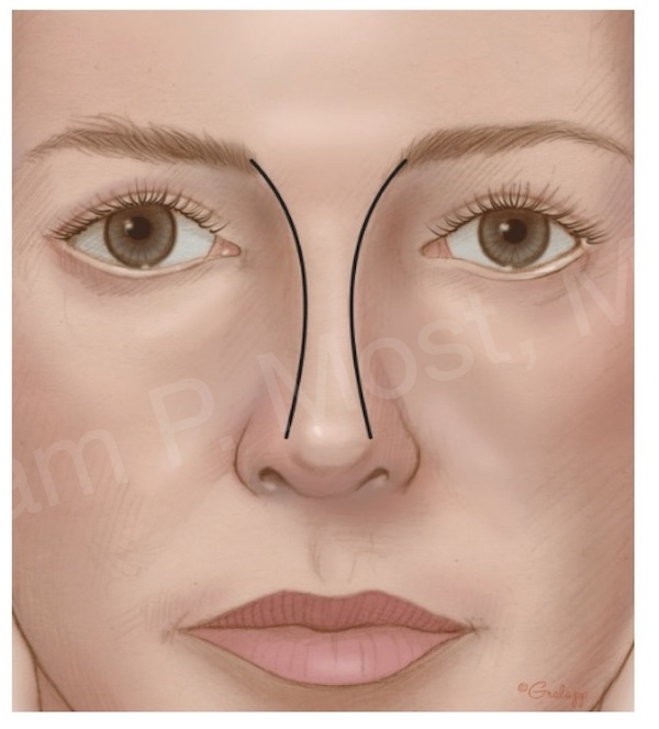 Fig 3-8
