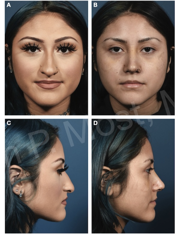 Fig 4-14