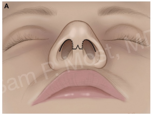 Fig 4-8