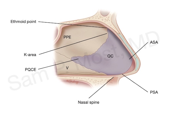 Fig 5-1