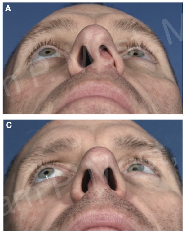 Figure 5–6: ASR patient result