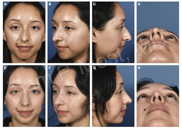Fig 5-8