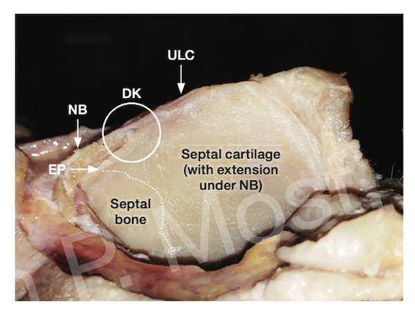 Figure 7-6: Dorsal anatomy