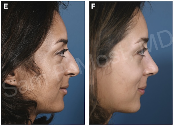 Figure 8-26: DPR patient 2
