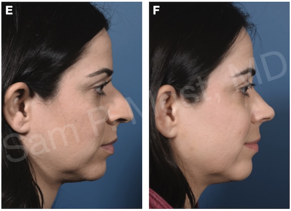 Figure 8-28: DPR patient 3