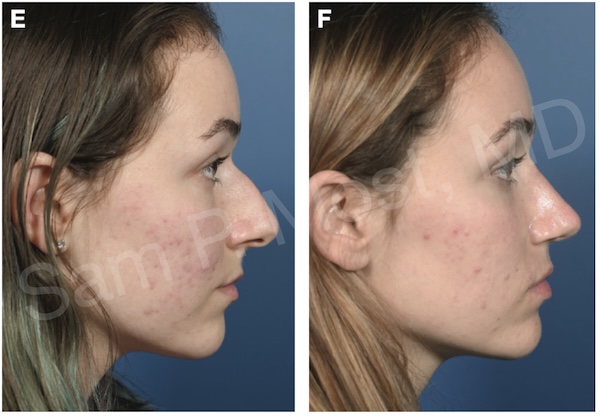 Figure 8-31: DPR patient 5