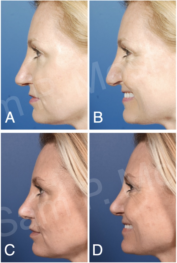 Figure 9-10: Further example of TIG in clinical use